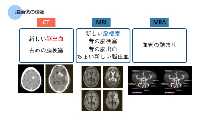 脳機能 脳画像の種類と見方 ぱられるゴリラ