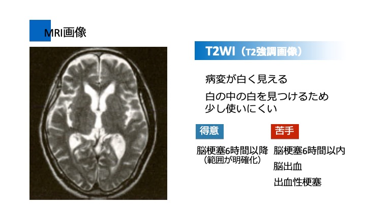 脳機能 脳画像の種類と見方 ぱられるゴリラ