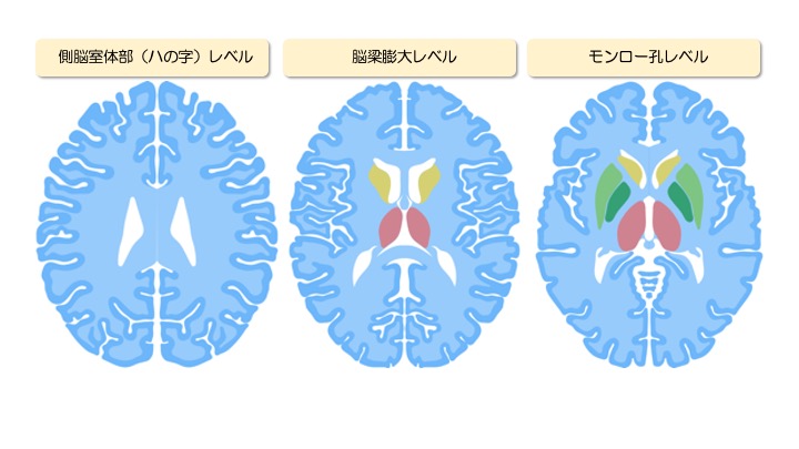 脳機能 大脳基底核について 新人療法士必見 ぱられるゴリラ