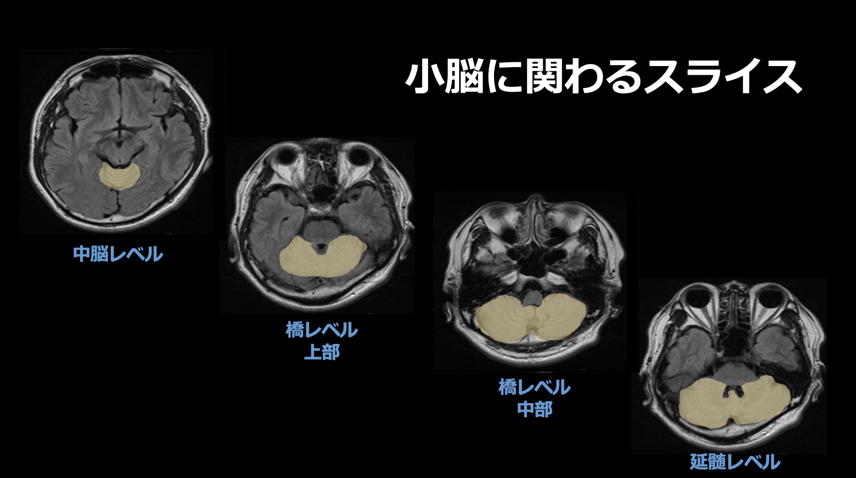 脳機能 小脳の機能についてわかりやすく説明 ぱられるゴリラ