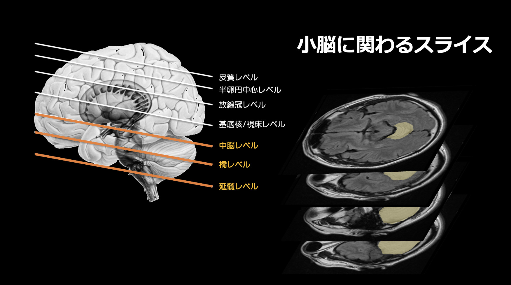 脳機能 小脳の機能についてわかりやすく説明 ぱられるゴリラ