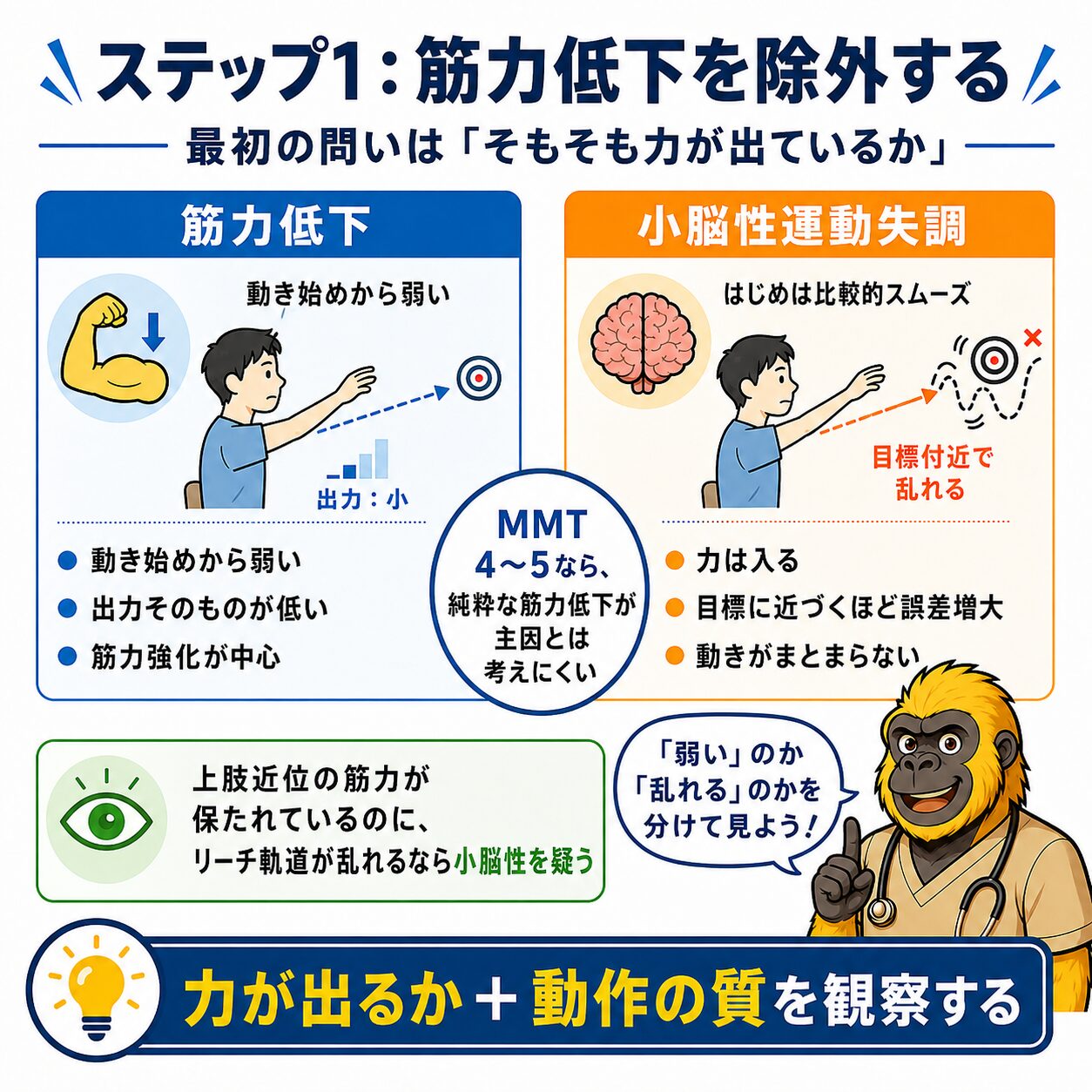 ステップ1：筋力低下を除外する。MMT4〜5で筋力低下は主因でない。動き始めと終末部の質の違いを見る
