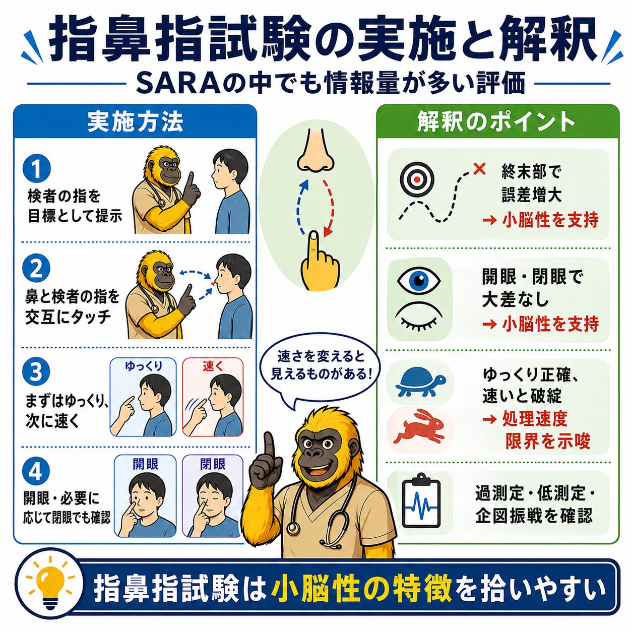 指鼻指試験の実施方法と解釈：実施4ステップと小脳性を支持する3つの所見
