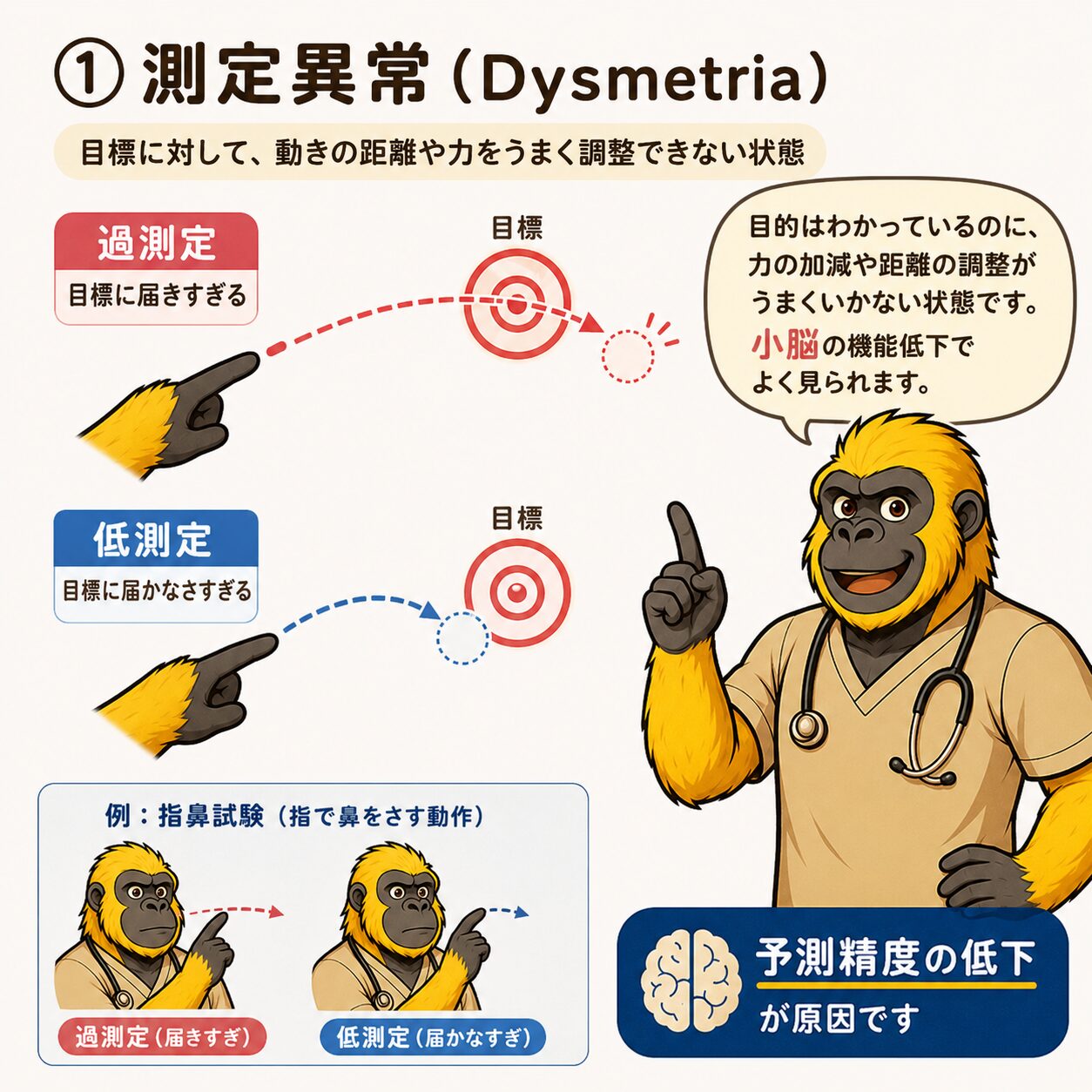 測定異常（Dysmetria）：過測定・低測定の違いと指鼻指試験での見方