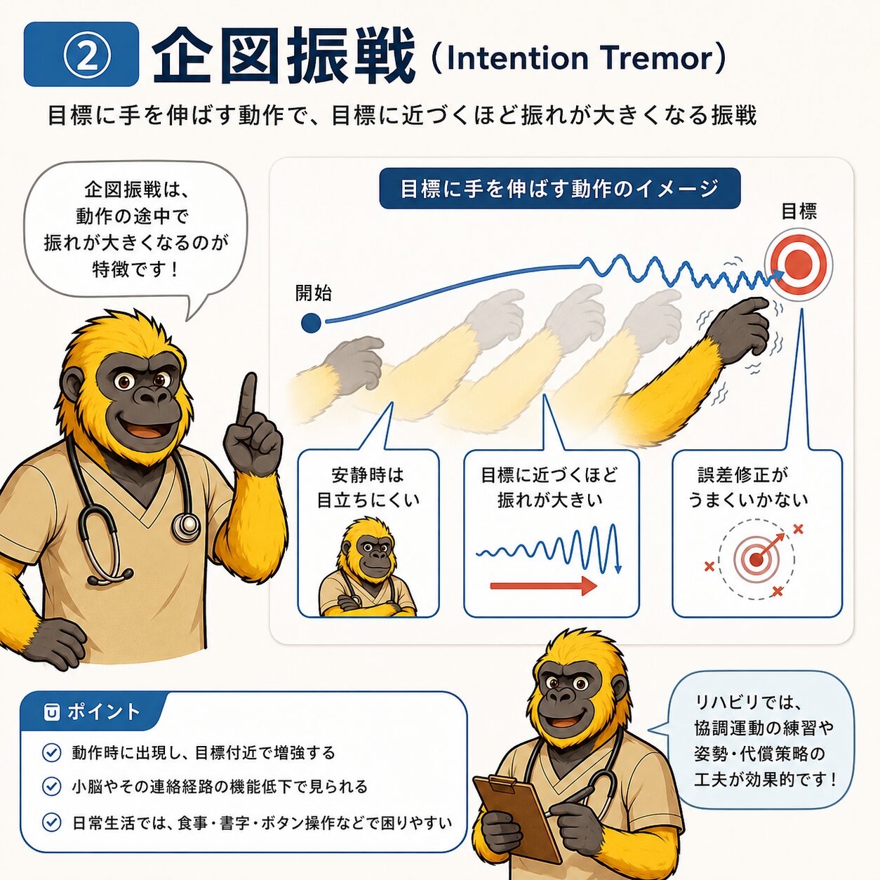 企図振戦（Intention Tremor）：目標に近づくほど振れが大きくなるメカニズム