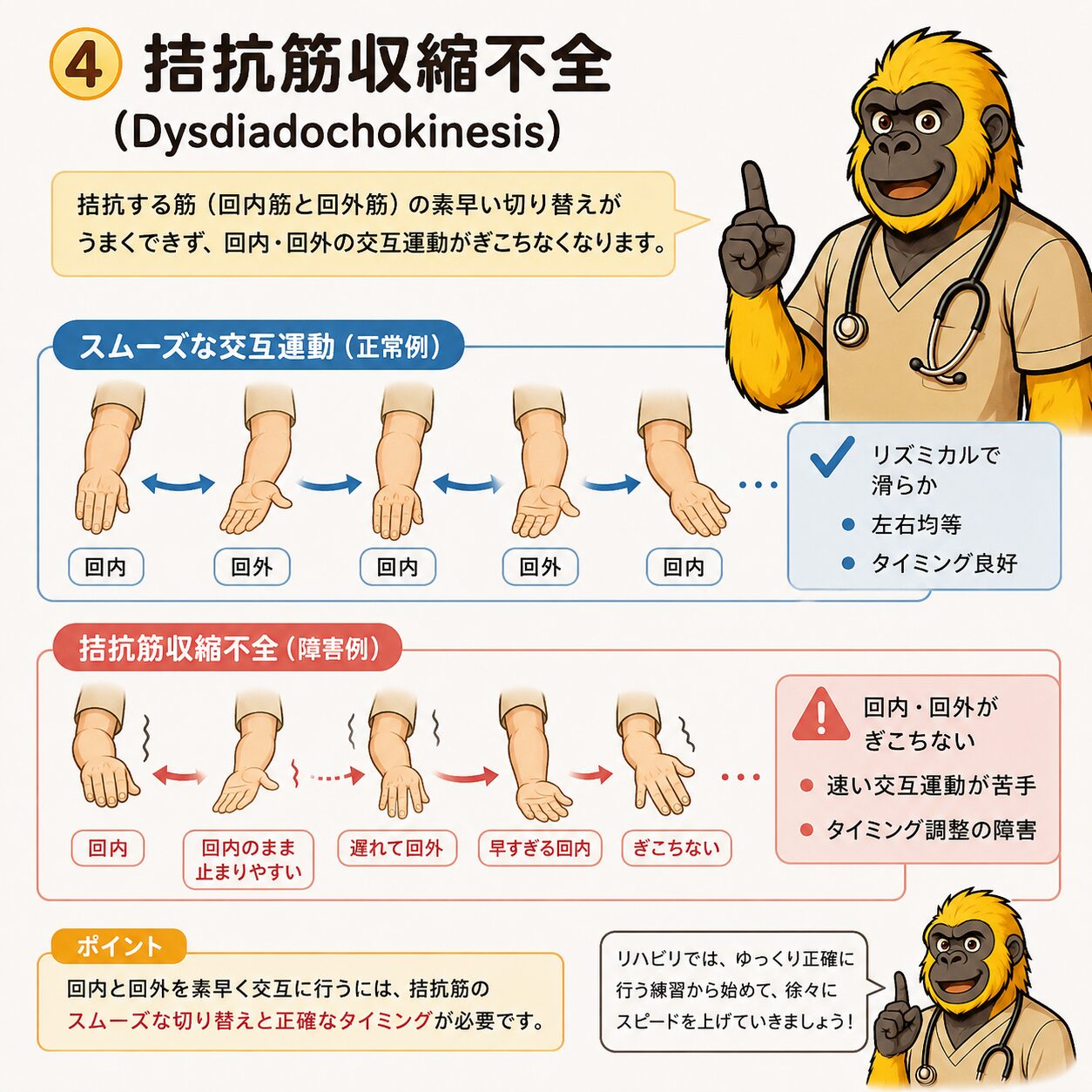 拮抗筋収縮不全（Dysdiadochokinesis）：スムーズな交互運動ができなくなる理由