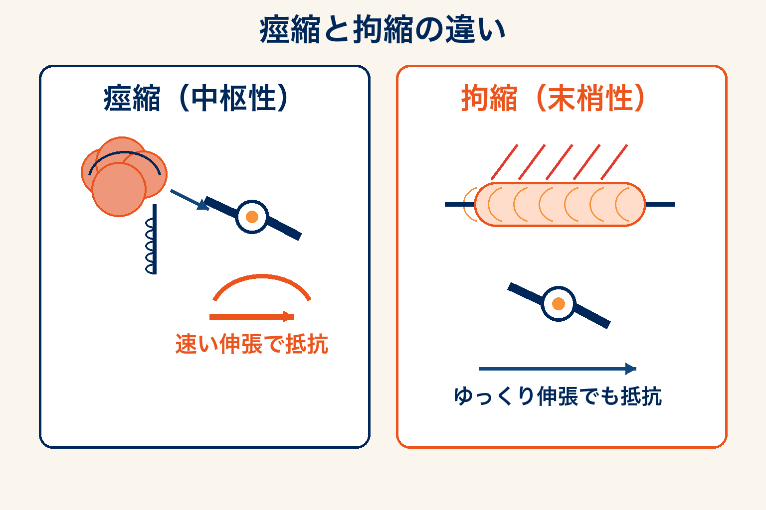 痙縮と拘縮の概念図:中枢性と末梢性の違い