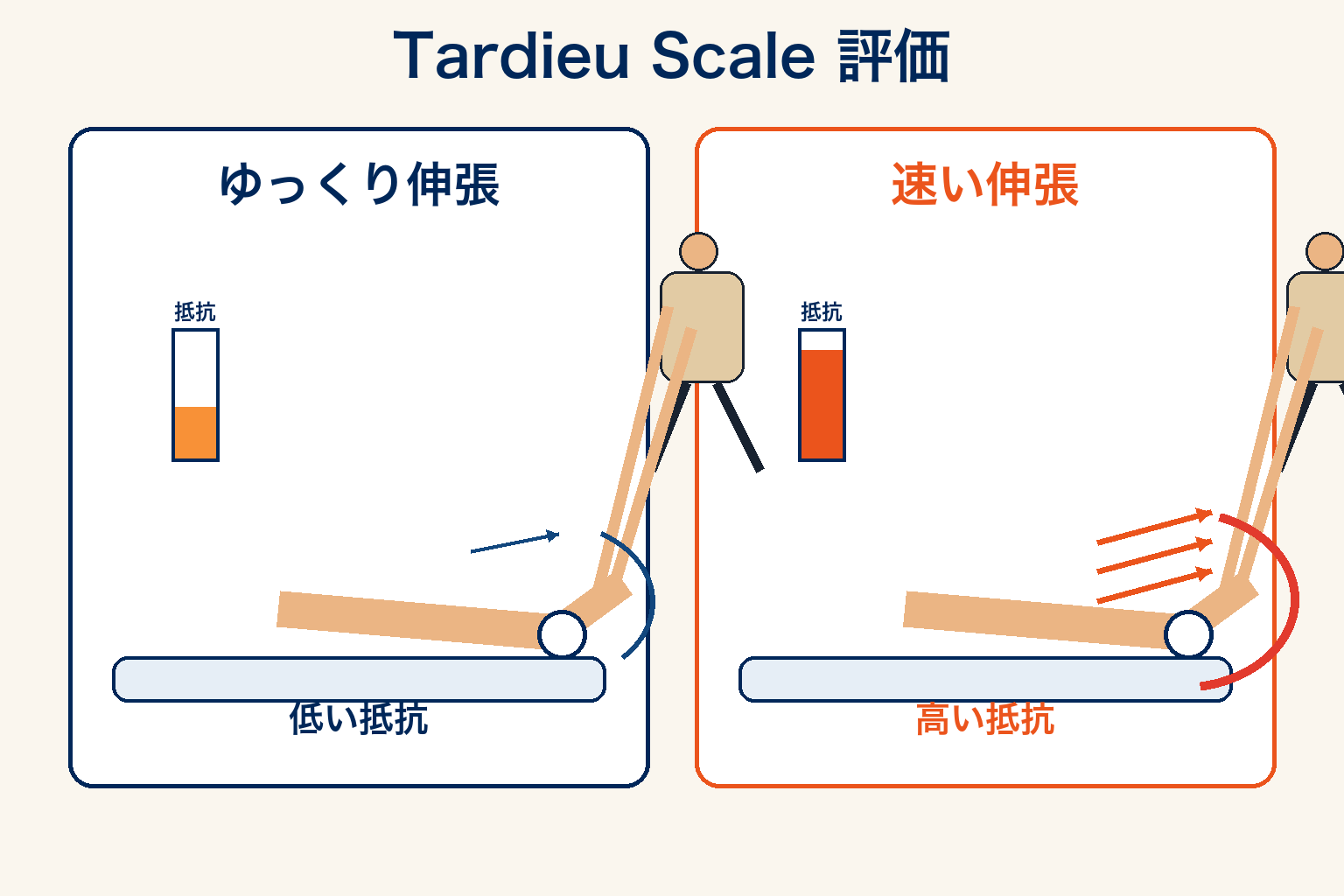 痙縮評価:速度を変えた伸張テストのイメージ