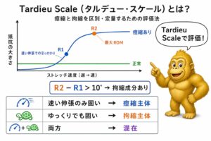 痙縮・拘縮への介入まとめ