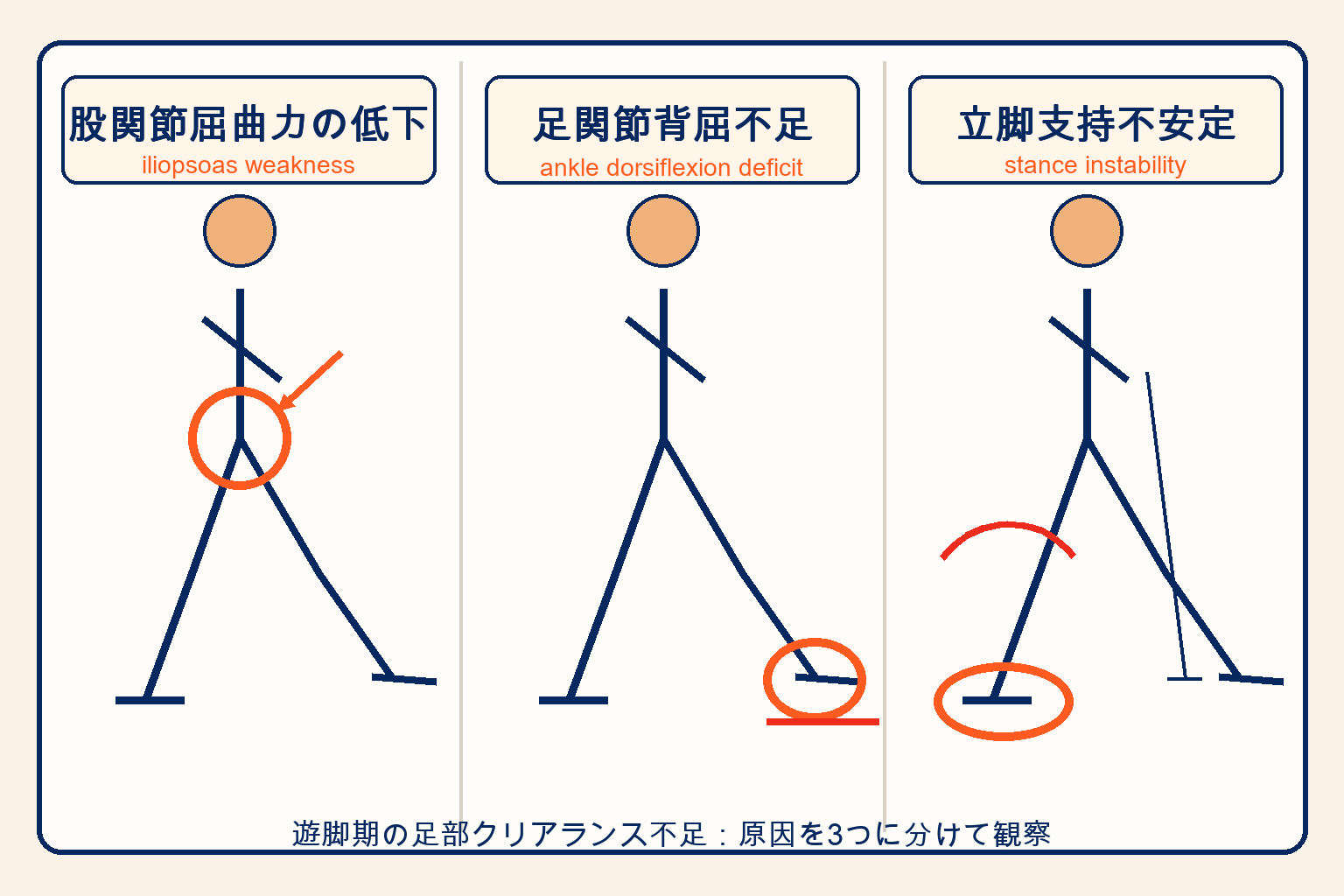 遊脚期障害の3原因：股関節屈曲・足関節背屈・立脚支持