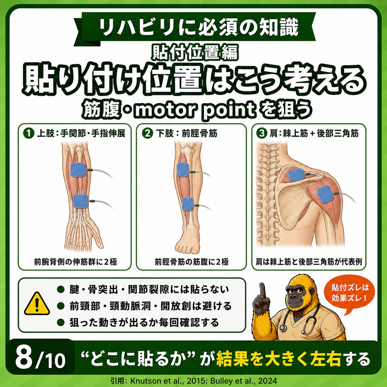 電気刺激の電極貼付位置:筋腹・motor pointの狙い方
