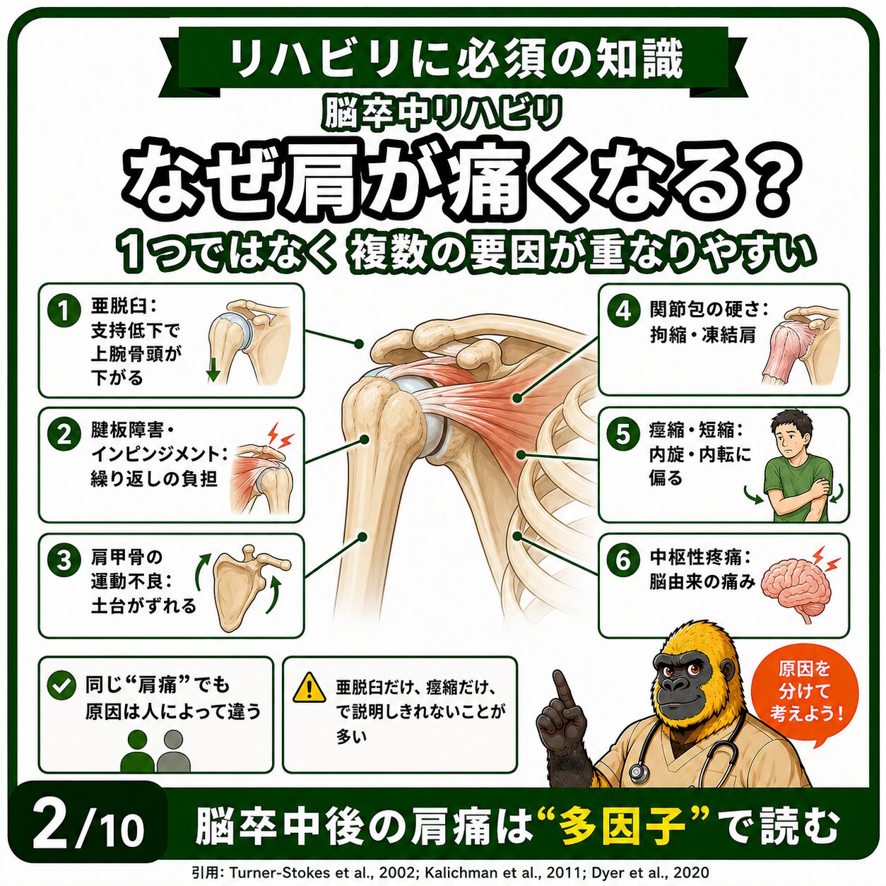 脳卒中後肩痛の6つの要因