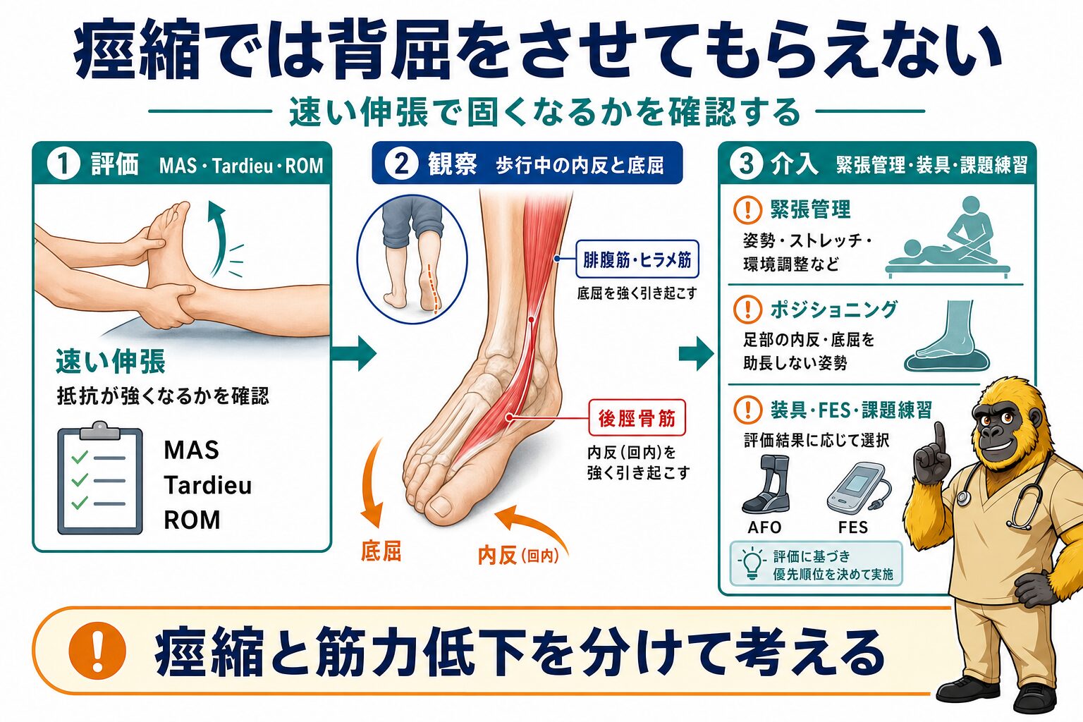 下腿三頭筋・後脛骨筋の痙縮と下垂足