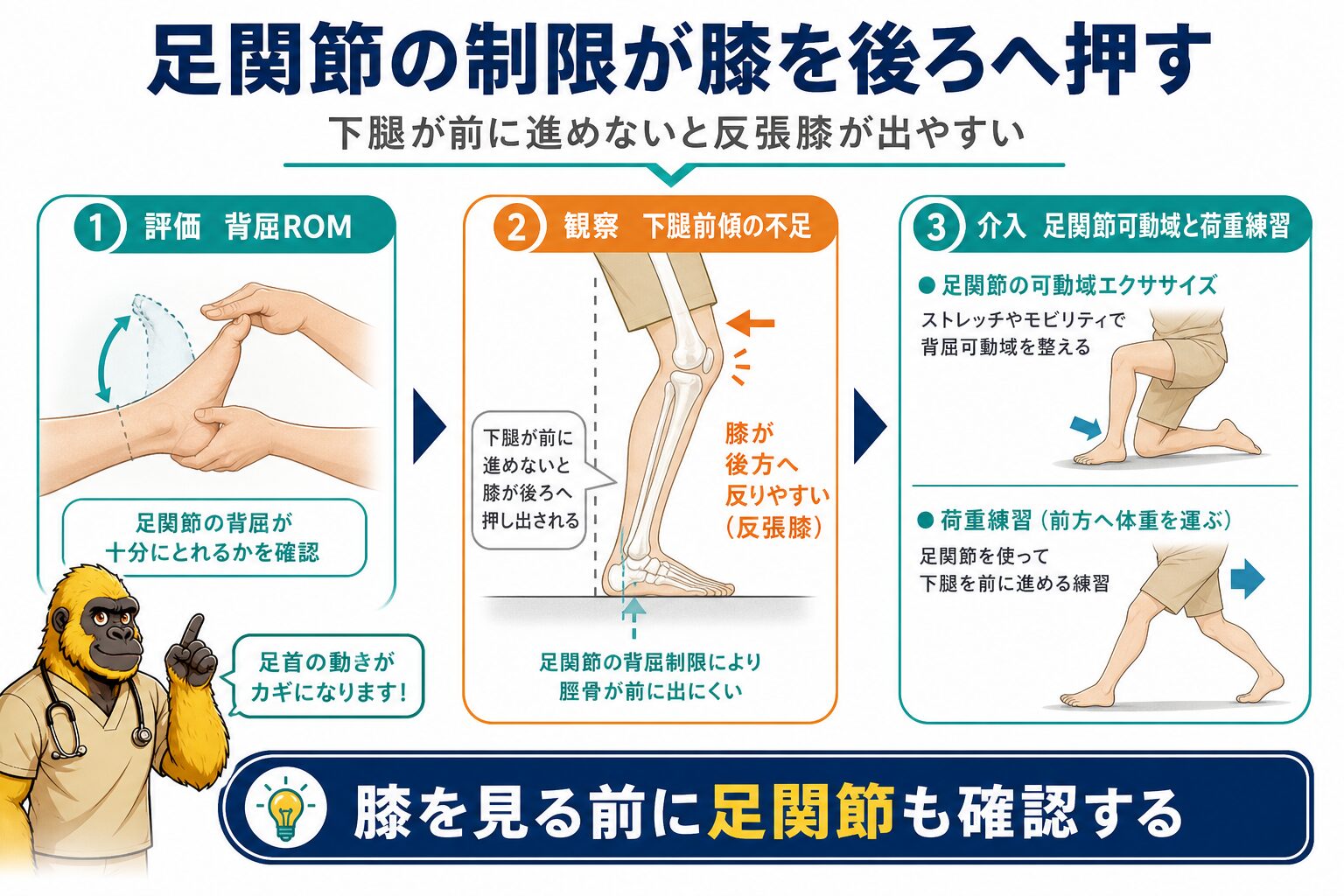 足関節底屈拘縮が引き起こす反張膝