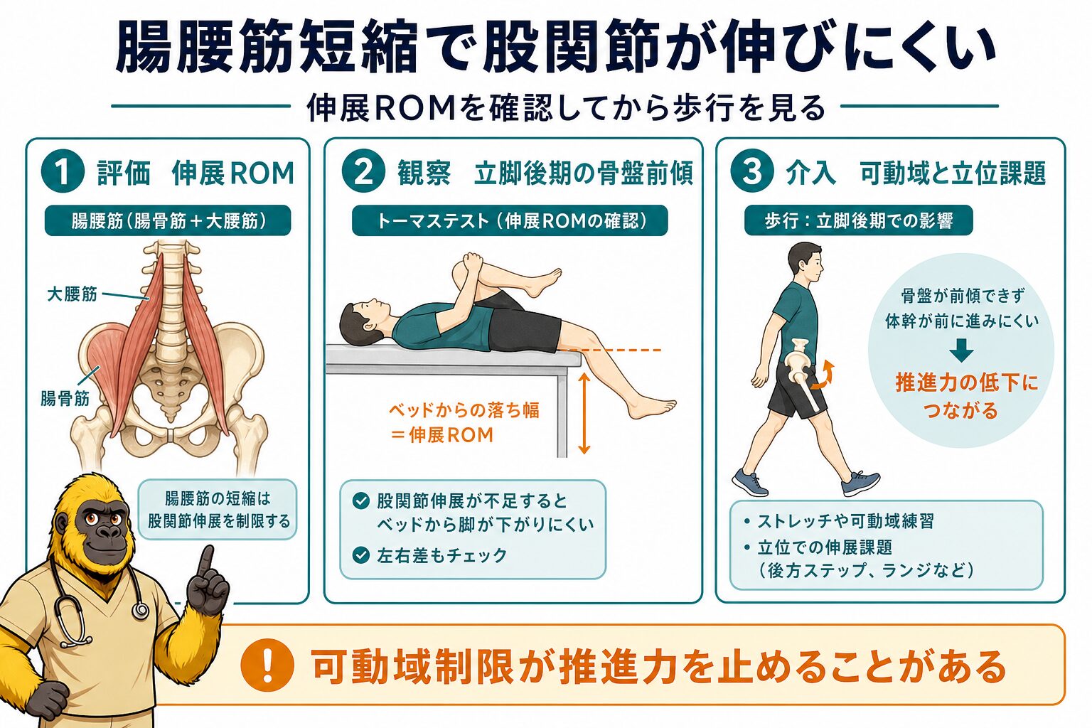 腸腰筋の短縮・痙縮と股関節伸展制限