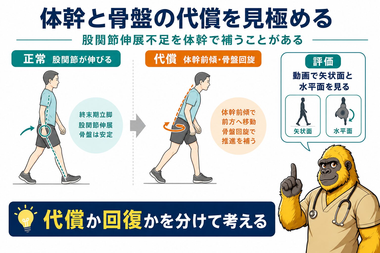 立脚後期の体幹前傾不足と股関節伸展