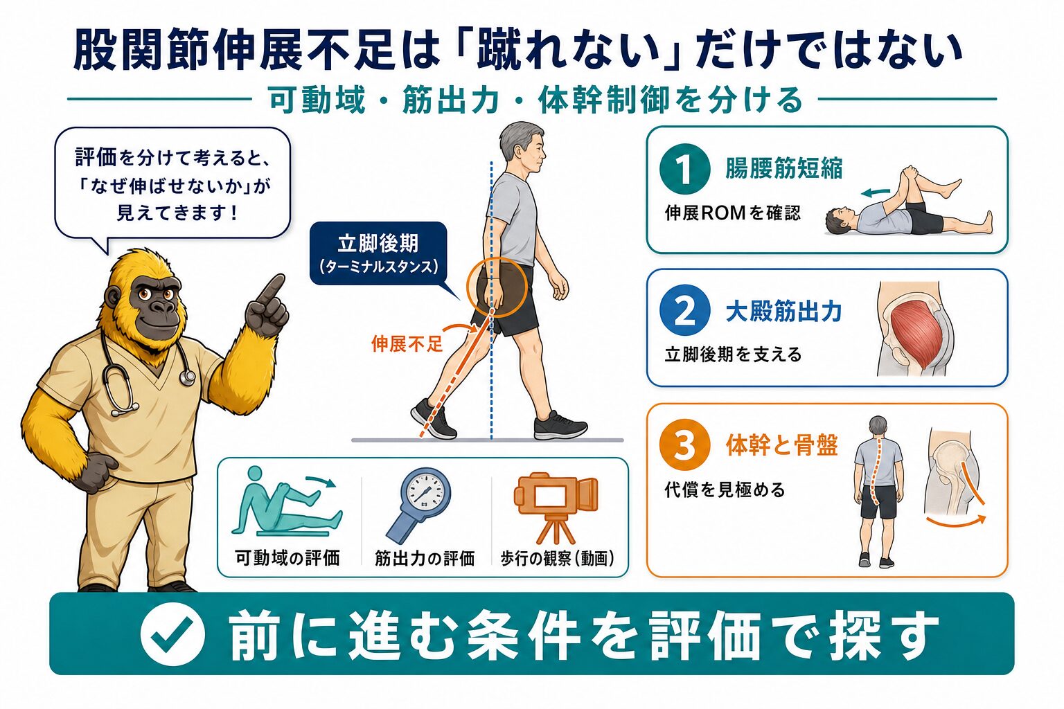 股関節伸展不足 評価まとめチャート