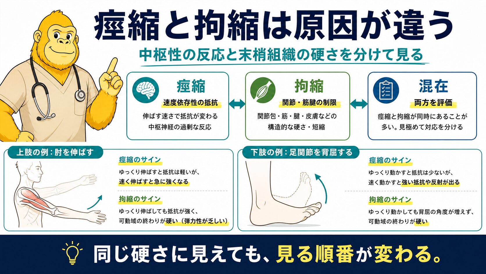 痙縮と拘縮の概念図：中枢性と末梢性の違い