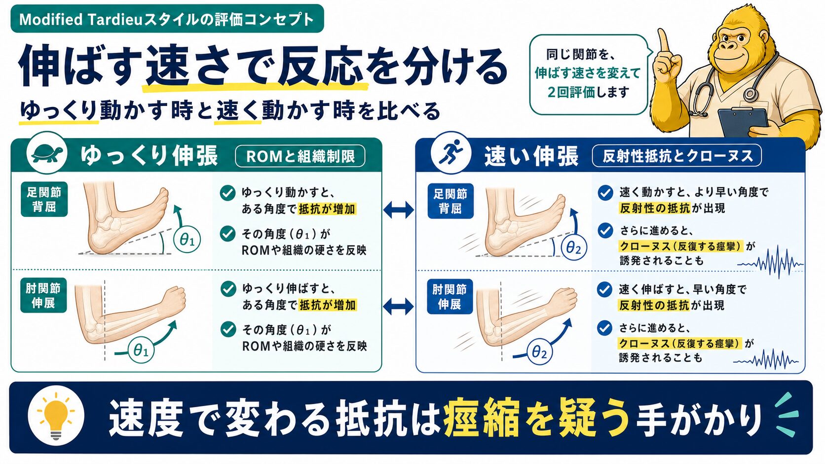 痙縮評価：速度を変えた伸張テストのイメージ