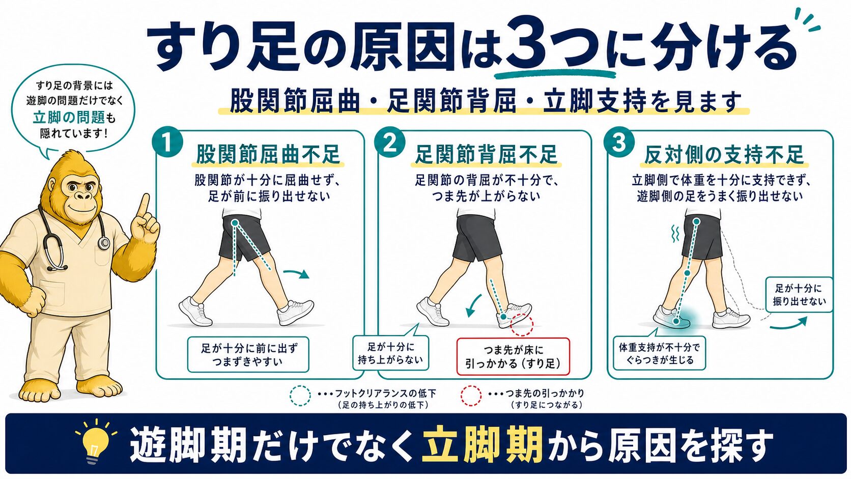 遊脚期障害の3原因：股関節屈曲・足関節背屈・立脚支持