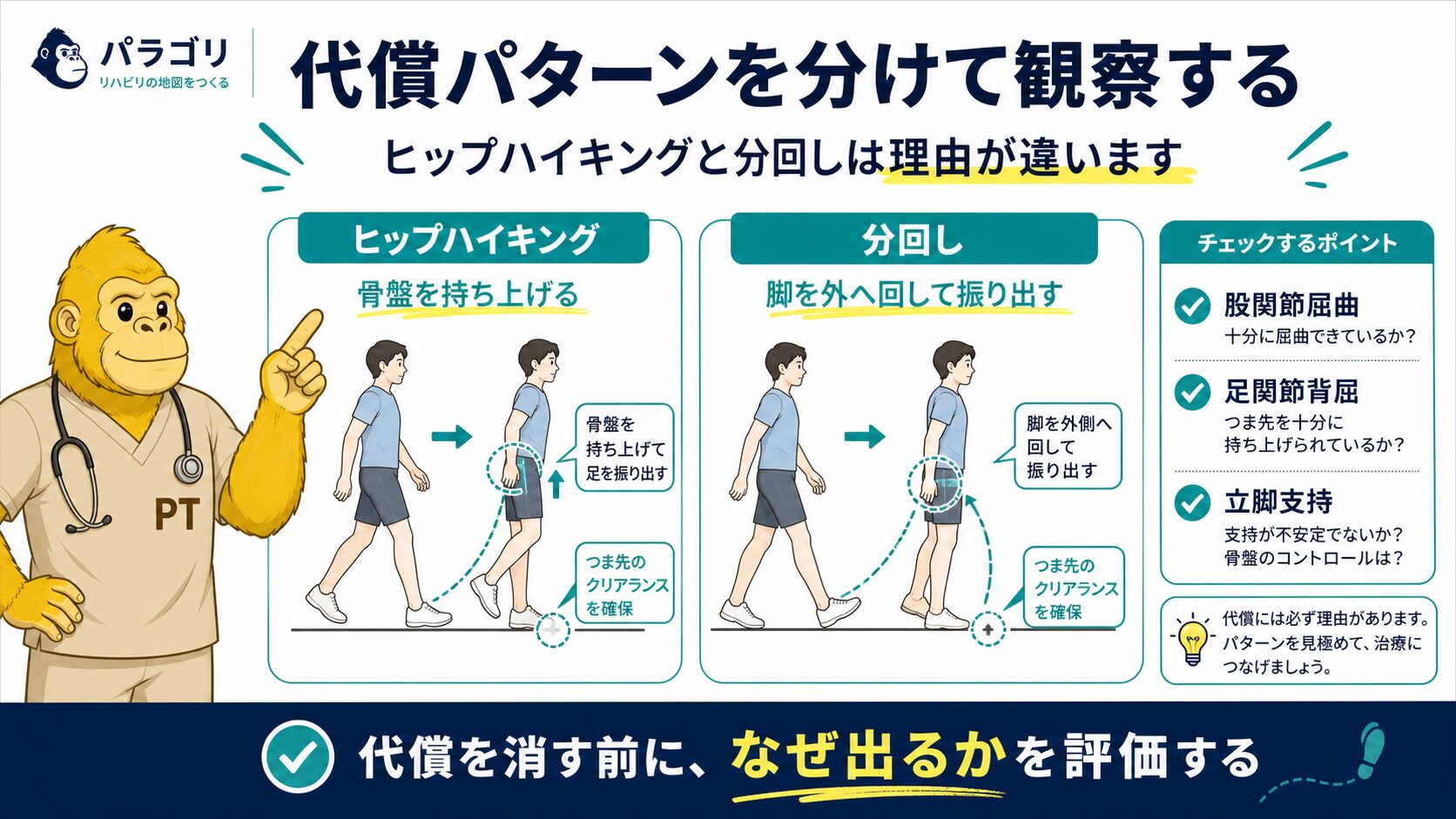 代償パターンの観察：ヒップハイキング・circumductionの見方