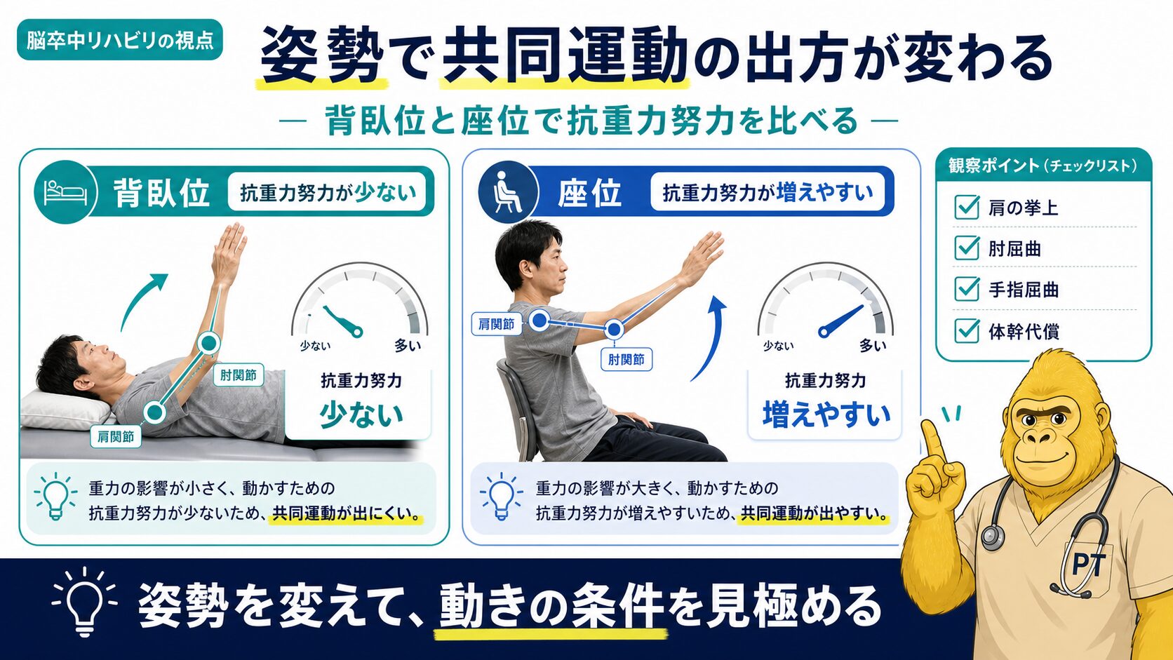 重力依存性シナジーの見極め:背臥位と座位での上肢反応比較