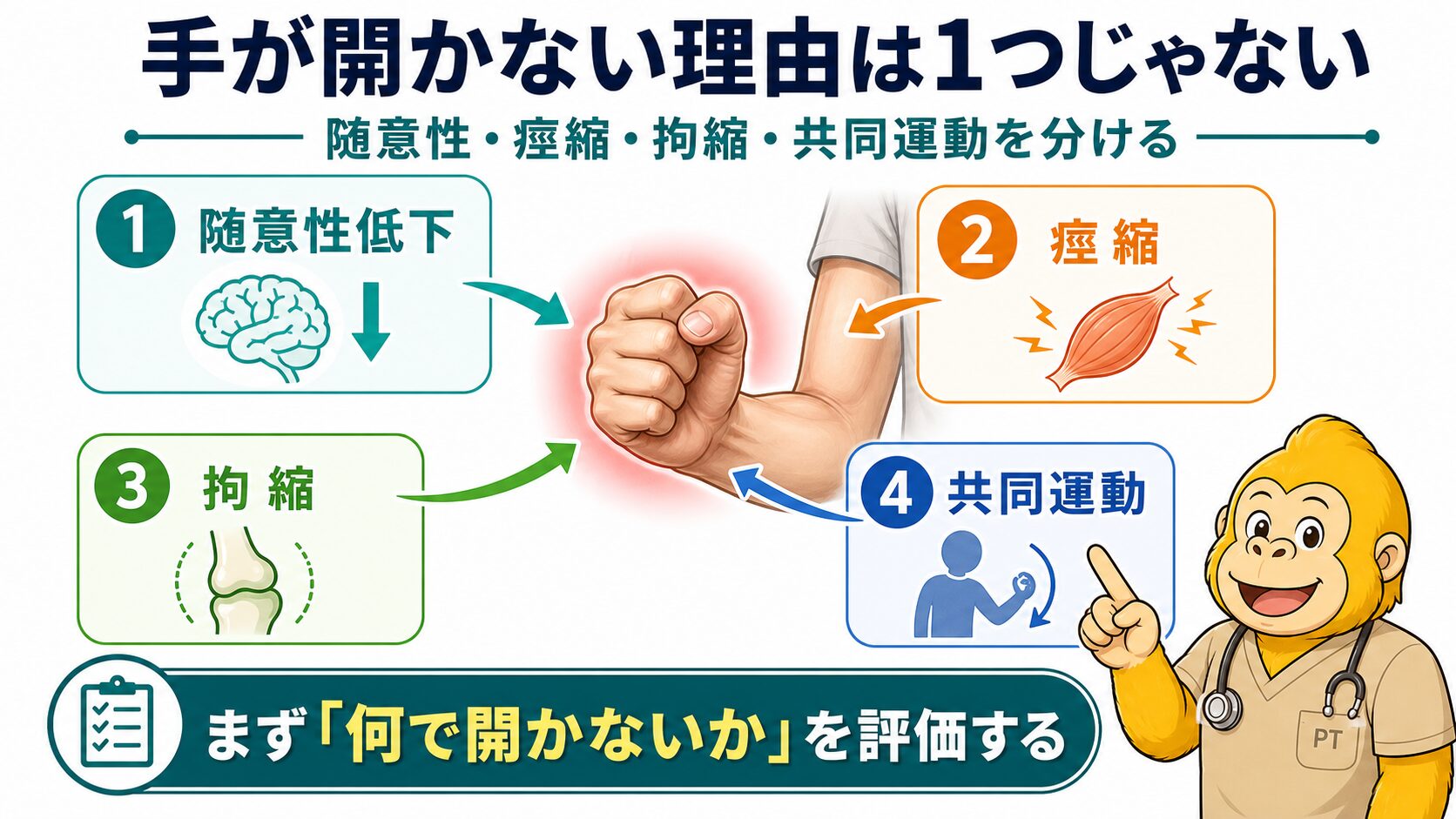 手が開かない理由の全体像