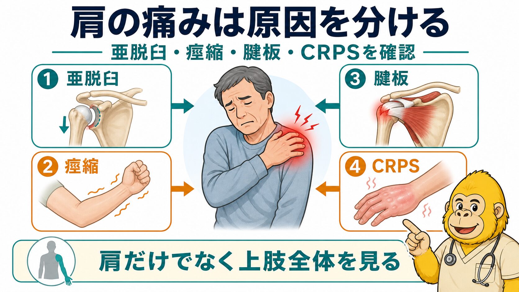 脳卒中後肩痛の全体像