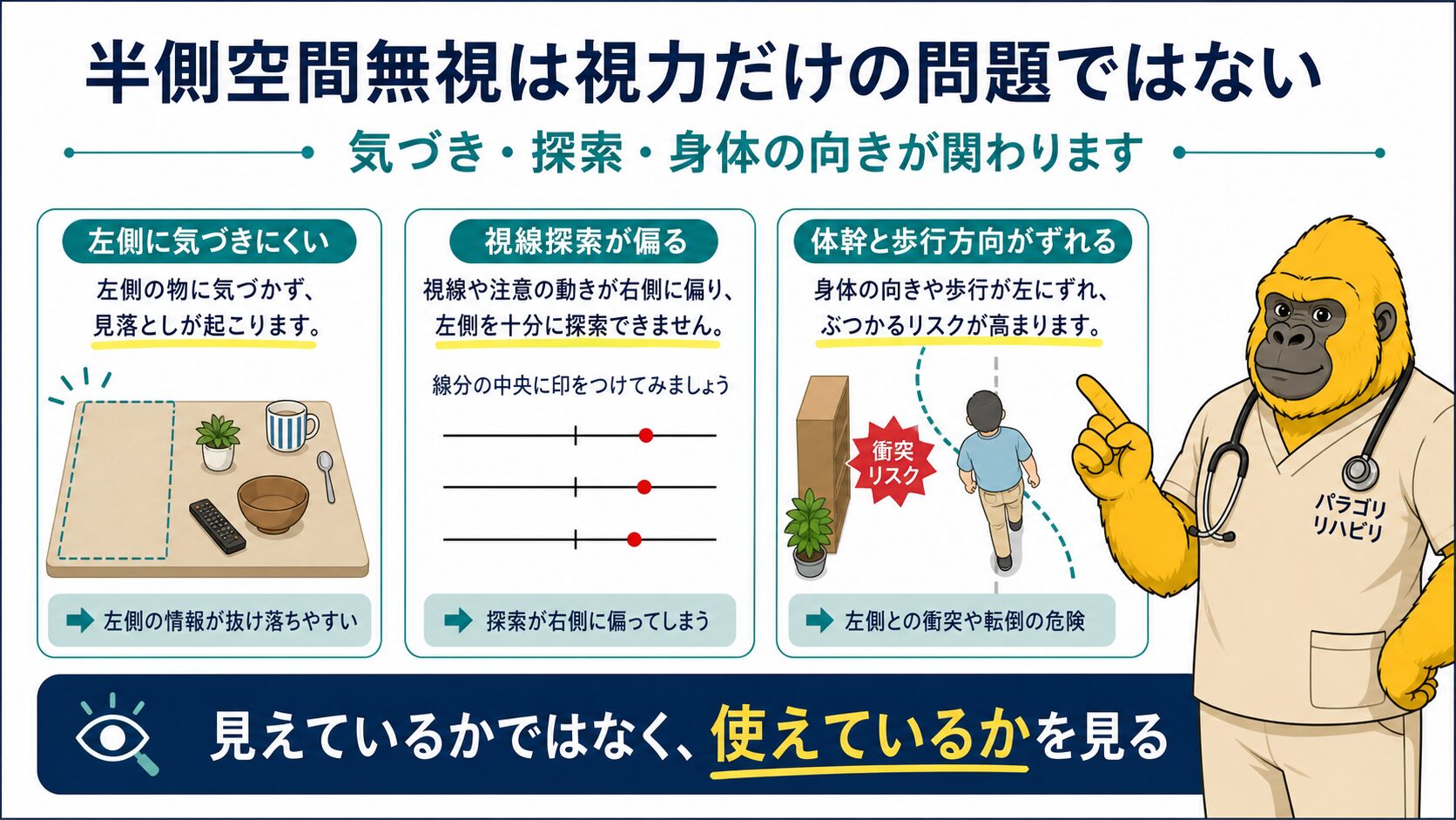 半側空間無視は視力だけの問題ではない
